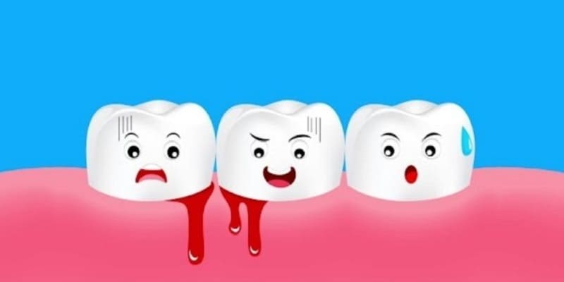 Tại sao lại nằm mộng thấy máu ở răng?